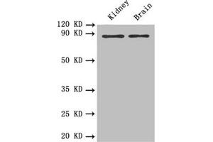 Western blot All lanes: PTPRE antibody at 0. (PTPRE Antikörper)