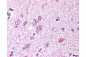Immunohistochemistry (IHC) image for anti-G Protein-Coupled Receptor 37 (Endothelin Receptor Type B-Like) (GPR37) (N-Term) antibody (ABIN2469255)