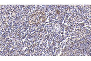 Detection of CXCL2 in Human Spleen Tissue using Polyclonal Antibody to Chemokine (C-X-C Motif) Ligand 2 (CXCL2) (CXCL2 Antikörper  (AA 34-107))