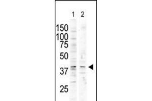 The anti-P38delta C-term Pab (ABIN6242133 and ABIN6578997) is used in Western blot to detect P38 delta in nocodazole-treated HC (lane 1) and A-treated Pam212 (lane 2) cell lysates. (MAPK13 Antikörper  (C-Term))