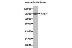 Western Blotting (WB) image for anti-RAS P21 Protein Activator (GTPase Activating Protein) 1 (RASA1) antibody (ABIN1874554) (RASA1 Antikörper)