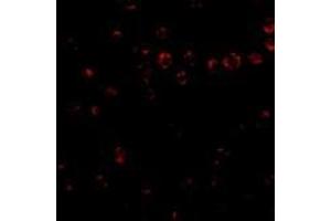 Immunofluorescence of Integrin alpha 4 in Jurkat cells with AP30435PU-N Integrin alpha 4 antibody at 2 μg/ml. (ITGA4 Antikörper  (Center))