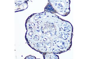 Immunohistochemistry of paraffin-embedded human placenta using N-WASP/N-WASP/WASL Rabbit mAb (ABIN7268856) at dilution of 1:100 (40x lens). (Neural Wiskott-Aldrich syndrome protein (WASL) Antikörper)