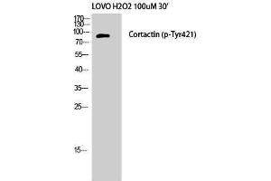 Western Blotting (WB) image for anti-Cortactin (CTTN) (pTyr421) antibody (ABIN3181971) (Cortactin Antikörper  (pTyr421))