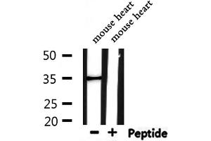 Western blot analysis of extracts from mouse heart, using ARG1 Antibody.