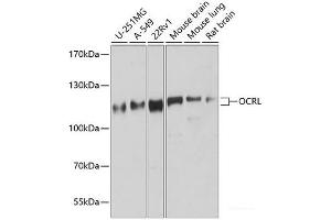 Western blot analysis of extracts of various cell lines using OCRL Polyclonal Antibody at dilution of 1:1000. (OCRL Antikörper)