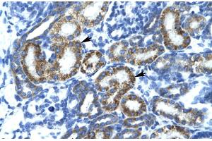 Rabbit Anti-FLJ14768 Antibody Catalog Number: ARP30009 Paraffin Embedded Tissue: Human Kidney Cellular Data: Epithelial cells of renal tubule Antibody Concentration: 4.