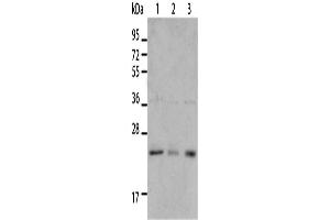 Western Blotting (WB) image for anti-BCL2/adenovirus E1B 19kDa Interacting Protein 1 (BNIP1) antibody (ABIN2421093) (BNIP1 Antikörper)