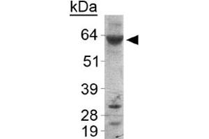 Western blot analysis of PLIN1 in human liver samples with PLIN1 polyclonal antibody . (PLIN1 Antikörper  (AA 450-522))