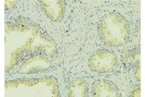 Immunohistochemistry (IHC) image for anti-ATPase, Cu++ Transporting, alpha Polypeptide (ATP7A) (C-Term) antibody (ABIN6260136)