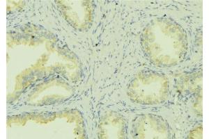 ABIN6278425 at 1/100 staining Mouse colon tissue by IHC-P. (ATP7A Antikörper  (C-Term))