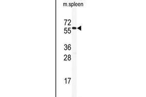 Western Blotting (WB) image for anti-Histone Deacetylase 2 (HDAC2) (AA 456-488), (C-Term) antibody (ABIN6242378)