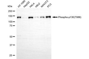 Western blotting analysis using phospho-p130(T986) antibody (ABIN7799666).
