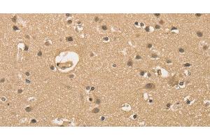 Immunohistochemistry of paraffin-embedded Human brain using ALDH8A1 Polyclonal Antibody at dilution of 1:30 (ALDH8A1 Antikörper)