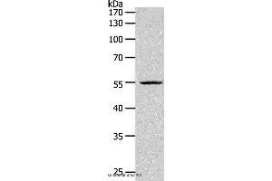 Western blot analysis of K562 cell, using PAX1 Polyclonal Antibody at dilution of 1:1200 (PAX1 Antikörper)