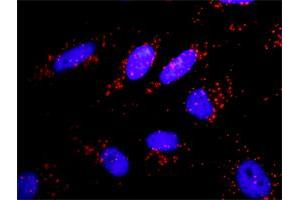 Proximity Ligation Assay (PLA) image for anti-Adaptor Protein, phosphotyrosine Interaction, PH Domain and Leucine Zipper Containing 1 (APPL1) (AA 1-709) antibody (ABIN525570)
