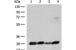 Western blot analysis of 231 K562 Jurkat and Raji cell lysates using CD48 Polyclonal Antibody at dilution of 1:550 (CD48 Antikörper)