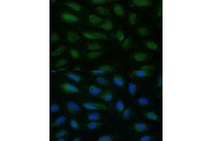 Immunofluorescence analysis of U-2 OS cells using HIBCH antibody (ABIN7265331) at dilution of 1:100. (HIBCH Antikörper  (AA 33-330))