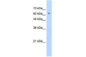 WB Suggested Anti-ZNF274 Antibody Titration: 2.