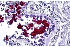 Human Lung: Formalin-Fixed, Paraffin-Embedded (FFPE) (MUC5AC Antikörper)