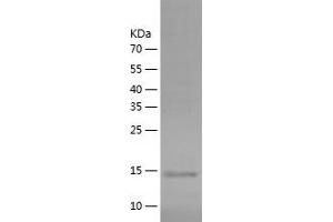 Western Blotting (WB) image for Platelet/endothelial Cell Adhesion Molecule (PECAM1) (AA 28-150) protein (His tag) (ABIN7124483)