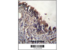 NUDT9 Antibody immunohistochemistry analysis in formalin fixed and paraffin embedded human lung tissue followed by peroxidase conjugation of the secondary antibody and DAB staining. (NUDT9 Antikörper  (C-Term))