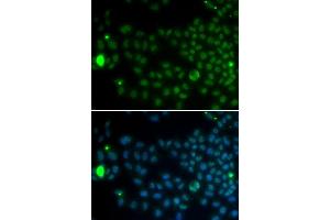 Immunofluorescence analysis of MCF7 cell using SPDYA antibody. (SPDYA Antikörper  (AA 1-313))