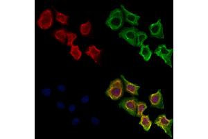 ABIN6264044 and ABIN6273287 staining Hela cells by IF/ICC. (Parvin, beta Antikörper  (C-Term))