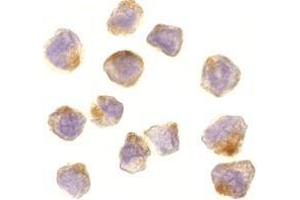 Immunocytochemistry of ASK1 in A431 cells with AP30085PU-N ASK1 antibody at 10 μg/ml.