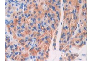 DAB staining on IHC-P; Samples: Mouse Ovary Tissue (Coagulation Factor V Antikörper  (AA 364-611))