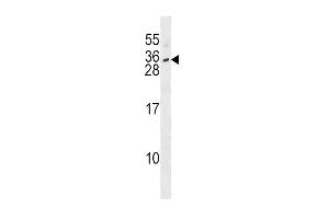 IL28B Antibody (N-term) (ABIN1539309 and ABIN2848533) western blot analysis in SK-BR-3 cell line lysates (35 μg/lane). (IL28B Antikörper  (N-Term))