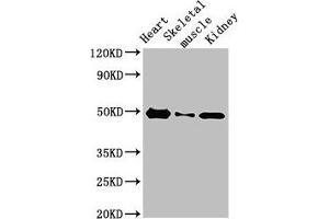 Western Blot Positive WB detected in: Rat heart tissue, Rat skeletal muscle, Mouse kidney tissue All lanes: ATP6V1C2 antibody at 3. (ATP6V1C2 Antikörper  (AA 190-262))