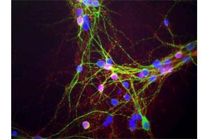 Mixed neuron-glial cultures stained with SNCA monoclonal antibody, clone 2A7 , our monoclonal antibody to SNCA (red) and chicken polylclonal antibody to MAP2 (green).