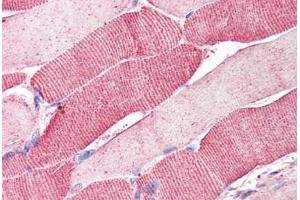 Human Skeletal Muscle (formalin-fixed, paraffin-embedded) stained with ARSB antibody ABIN337028 at 5 ug/ml followed by biotinylated anti-goat IgG secondary antibody ABIN481715, alkaline phosphatase-streptavidin and chromogen. (Arylsulfatase B Antikörper  (AA 359-372))