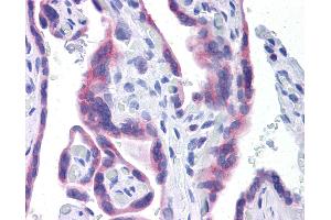 Anti-STT3A antibody IHC of human placenta. (STT3A Antikörper  (AA 603-702))