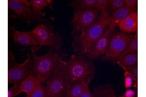 Immunofluorescence (IF) image for anti-Estrogen Receptor 1 (ESR1) (pSer167) antibody (ABIN1870177) (Estrogen Receptor alpha Antikörper  (pSer167))