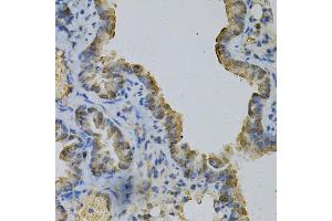 Immunohistochemistry of paraffin-embedded mouse lung using GLUL Antibody (ABIN5973158) at dilution of 1/100 (40x lens). (GLUL Antikörper)