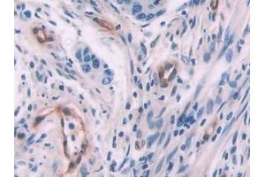 Immunohistochemistry (IHC) image for anti-Endoglin (ENG) (AA 26-136) antibody (ABIN7438025)