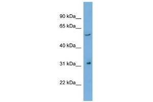 WB Suggested Anti-REM1 Antibody Titration: 0.