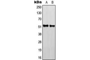 Western blot analysis of RGMB expression in HEK293T (A), NIH3T3 (B), H9C2 (C) whole cell lysates. (RGMB Antikörper  (Center))