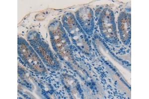 Used in DAB staining on fromalin fixed paraffin- embedded Kidney tissue (IGFBP4 Antikörper  (AA 22-254))