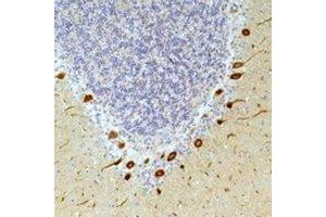 Immunohistochemical analysis of Ghrelin Receptor staining in human brain,human skin formalin fixed paraffin embedded tissue section. (GHSR Antikörper)