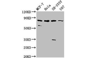 Western Blot Positive WB detected in: MCF-7 whole cell lysate, Hela whole cell lysate, SH-SY5Y whole cell lysate, U87 whole cell lysate All lanes: IL1RAPL1 antibody at 5. (IL1RAPL1 Antikörper  (AA 564-679))