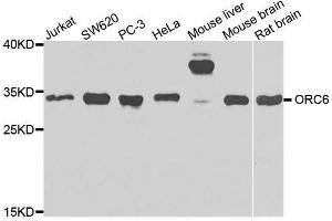 Western blot analysis of extracts of various cell lines, using ORC6 antibody. (ORC6 Antikörper  (AA 1-252))