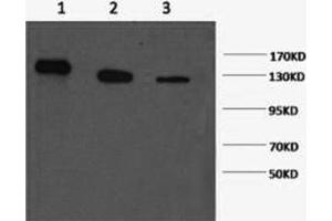 Western Blotting (WB) image for anti-Poly (ADP-Ribose) Polymerase 1 (PARP1) antibody (ABIN5958315) (PARP1 Antikörper)
