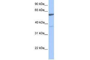 WB Suggested Anti-NAB2 Antibody Titration:  0. (NAB2 Antikörper  (C-Term))