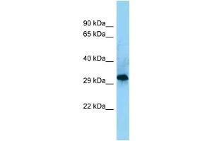 WB Suggested Anti-CD86 Antibody Titration: 1. (CD86 Antikörper  (C-Term))