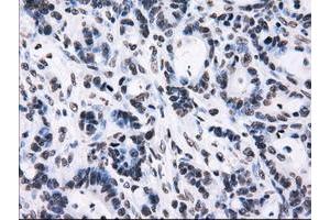 Image no. 9 for anti-Replication Protein A2, 32kDa (RPA2) antibody (ABIN1500736)