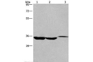 Western Blot analysis of Lovo cell,Human liver cancer tissue and Mouse kidney tissue using ING2 Polyclonal Antibody at dilution of 1:425 (ING2 Antikörper)