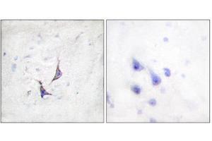 Immunohistochemistry (IHC) image for anti-Syndecan 4 (SDC4) (Ser179) antibody (ABIN1848043) (SDC4 Antikörper  (Ser179))